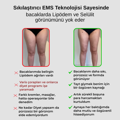 3'lü Etki Şekillendirici Lipödem, Selülit, Varis Silvesso™